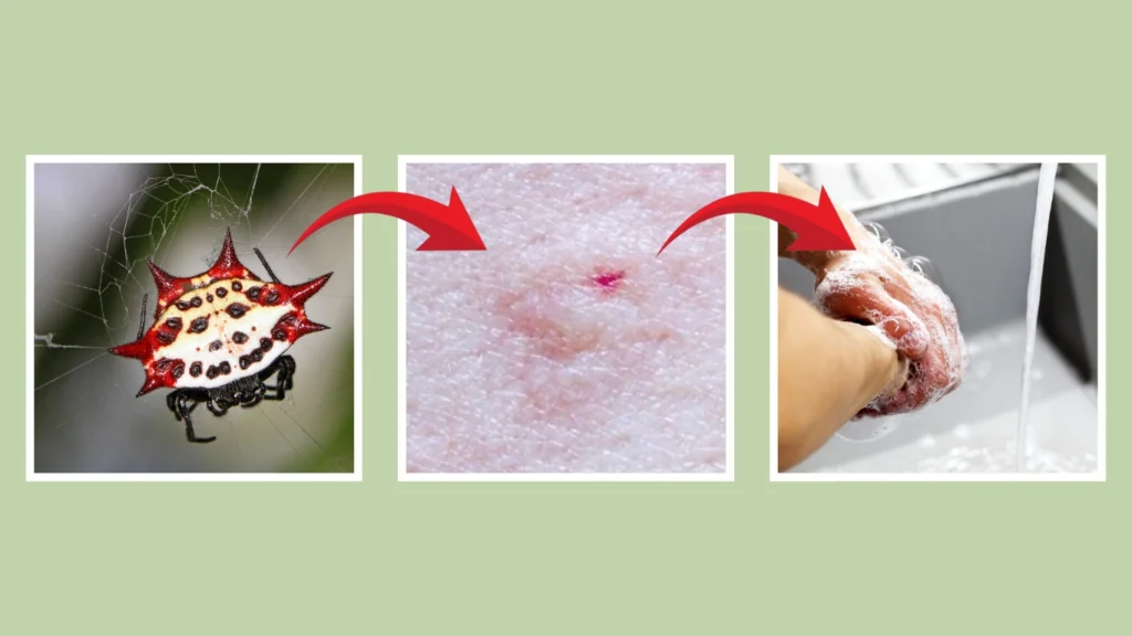 What to Do If You’re Bitten