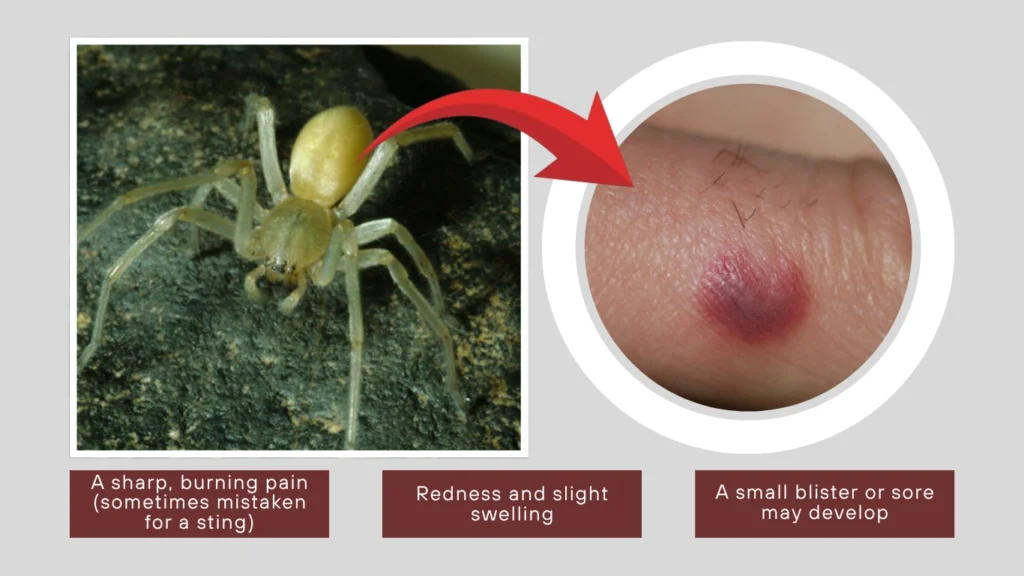 Yellow Sac Spider Bite – How Dangerous Is It