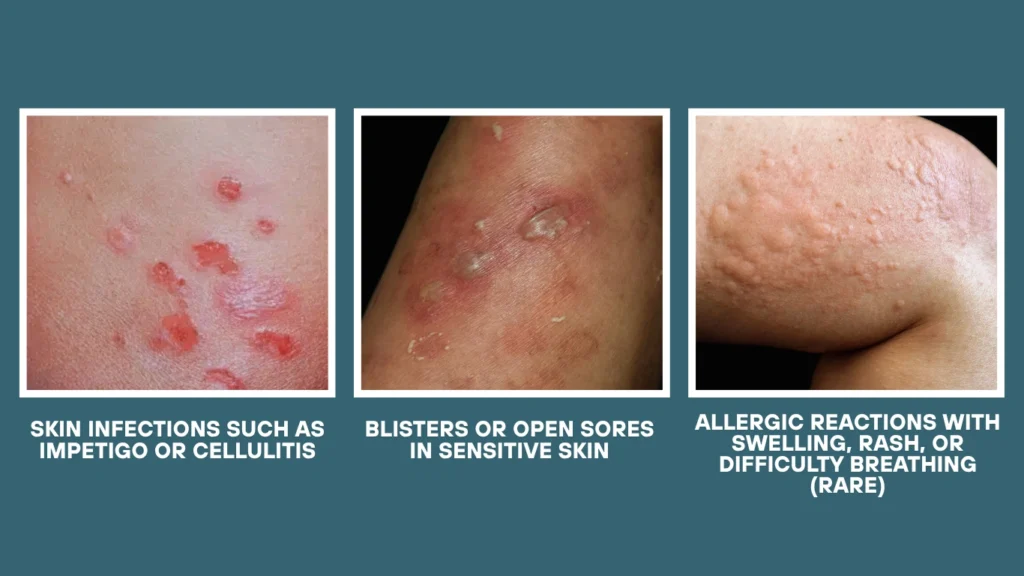 Are Bed Bug Bites Dangerous