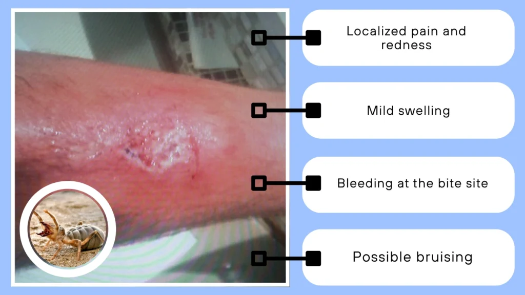 camel spider Bite Symptoms and Effects
