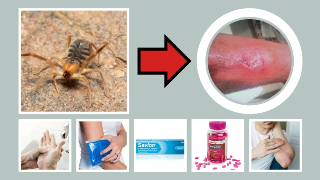 What Should You Do If Bitten by a Camel Spider?