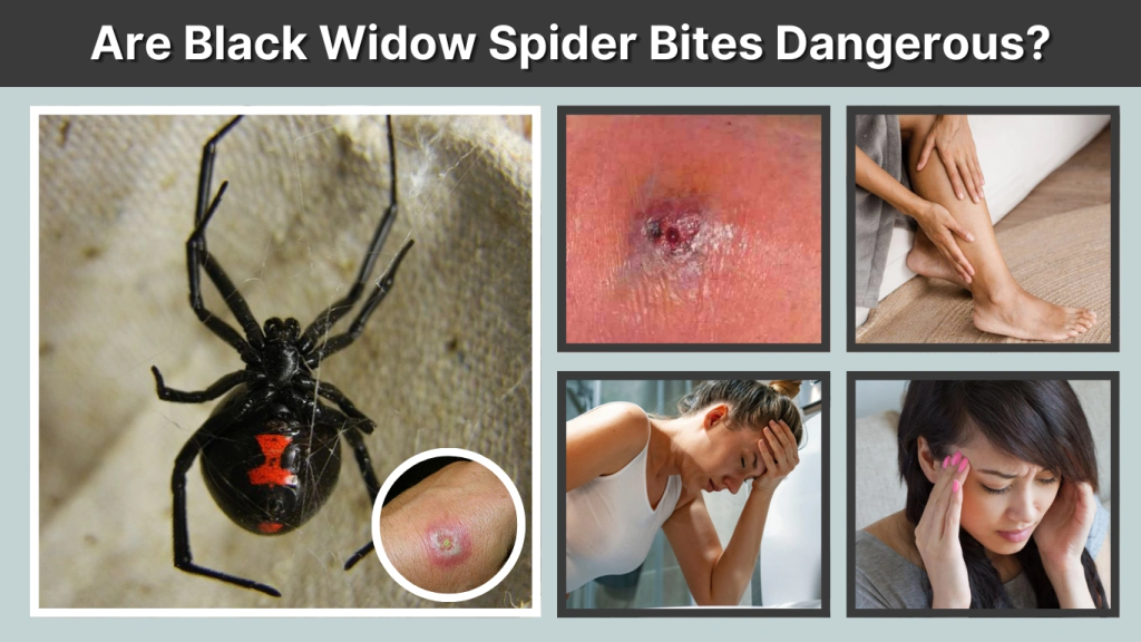 Are Black Widow Spider Bites Dangerous