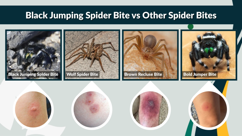 Black Jumping Spider Bite vs Other Spider Bites