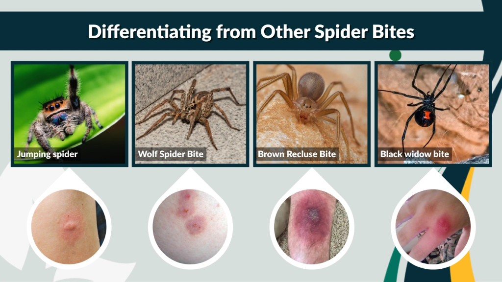Differentiating from Other Spider Bites