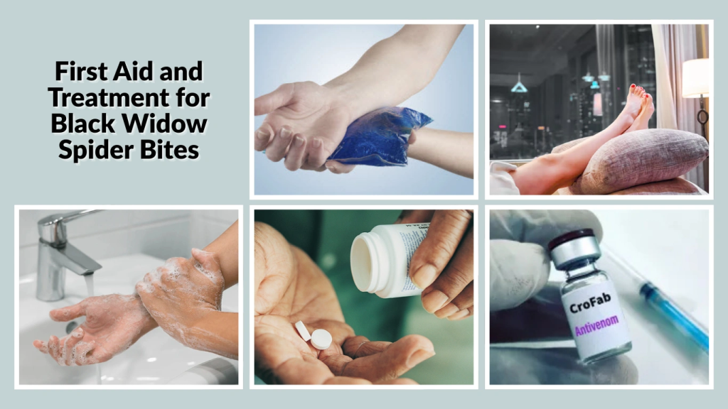 First Aid and Treatment for Black Widow Spider Bites