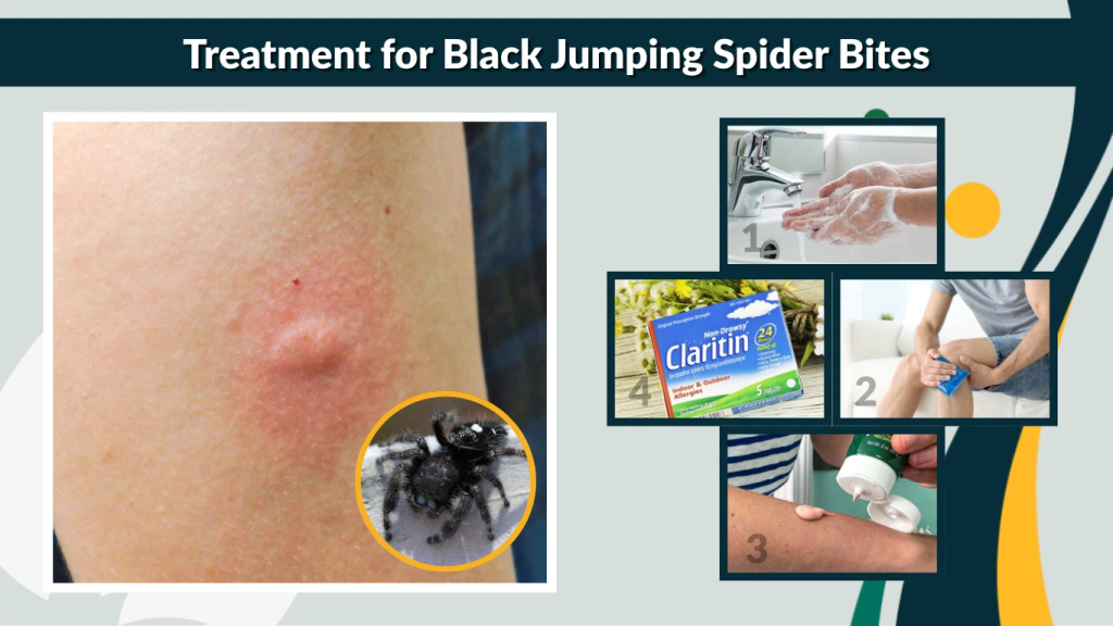Treatment for Black Jumping Spider Bites