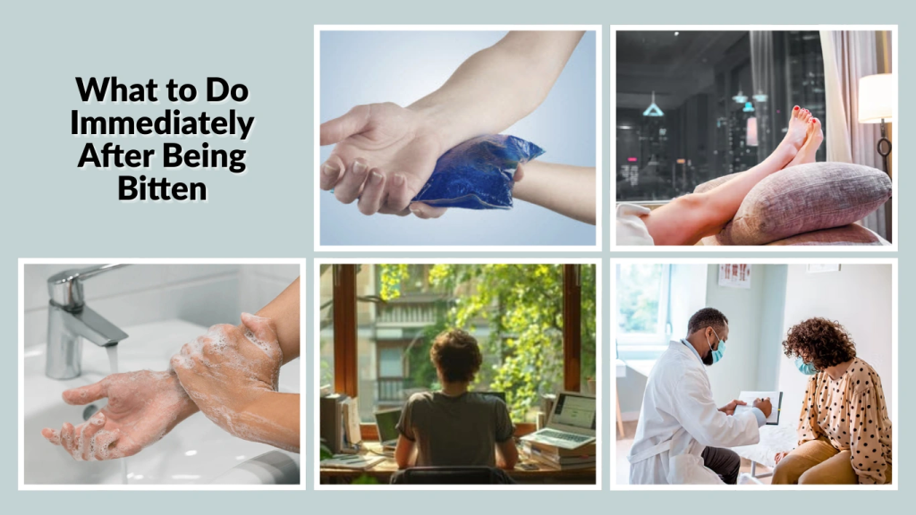 What to Do Immediately After Being Bitten