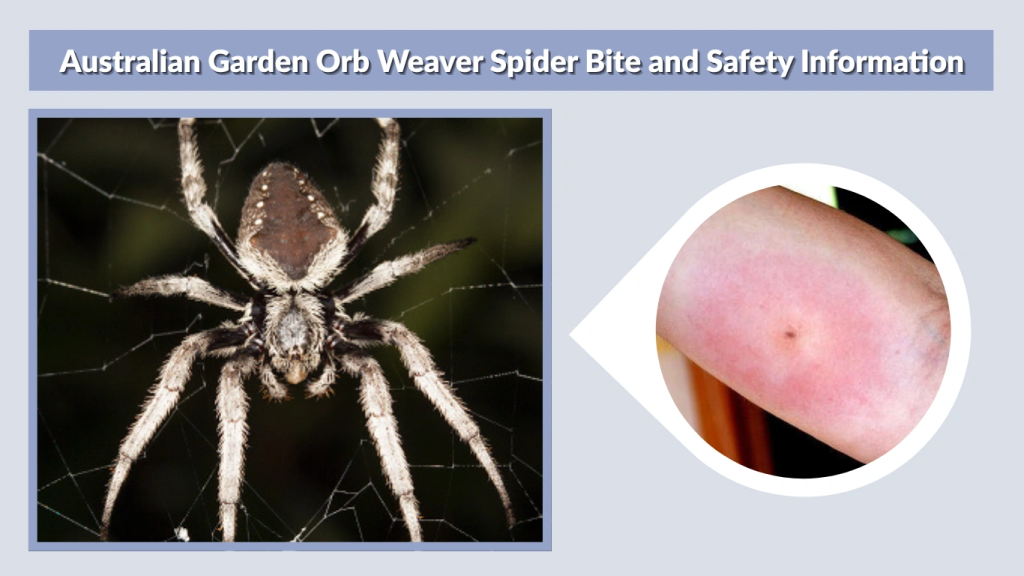Australian Garden Orb Weaver Spider Bite and Safety Information
