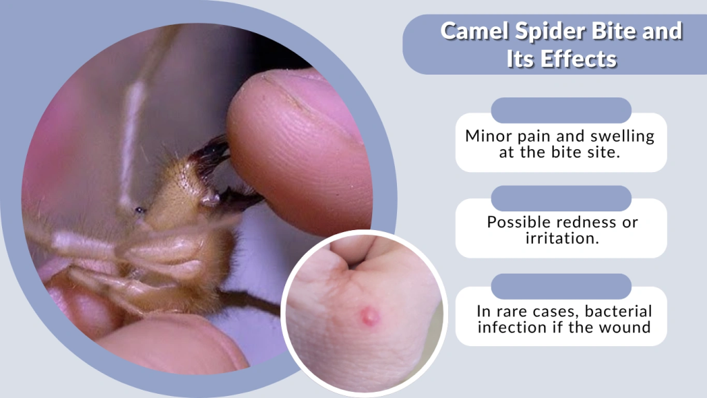 Camel Spider Bite and Its Effects
