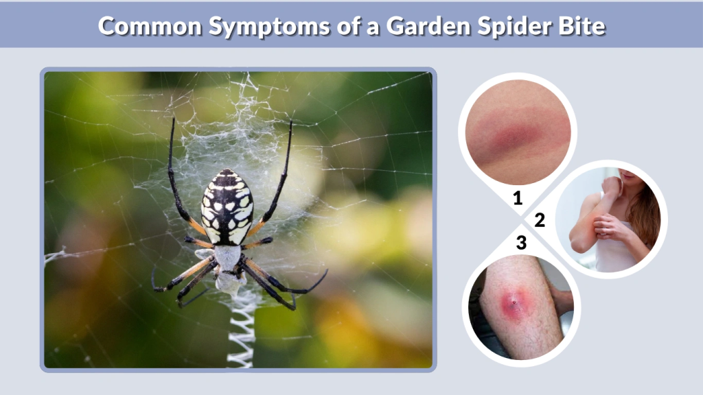 Common Symptoms of a Garden Spider Bite