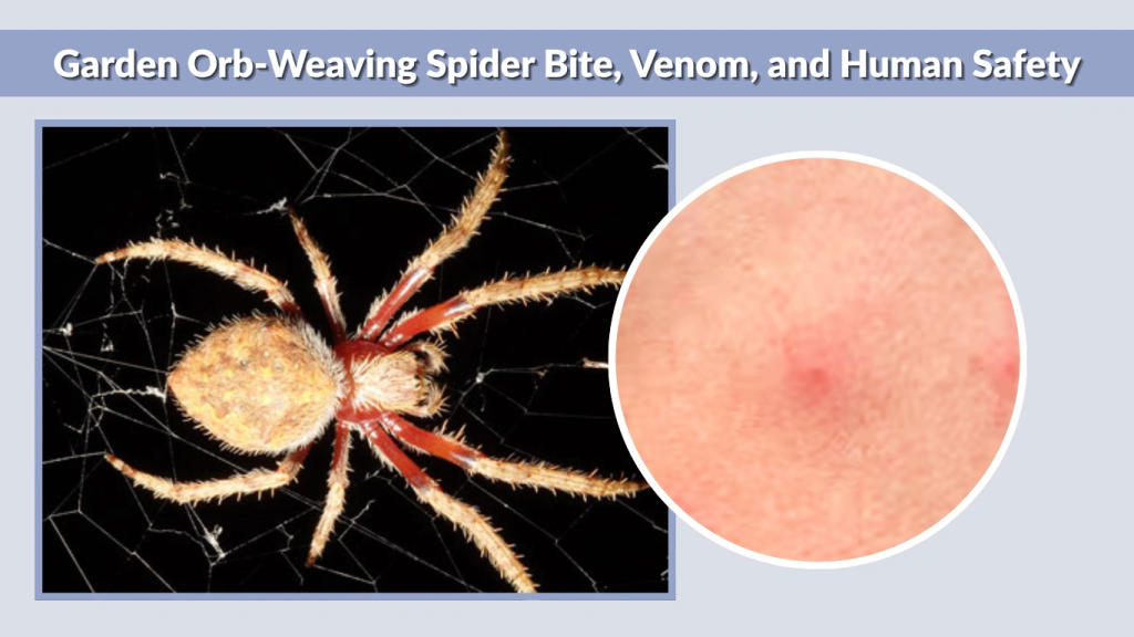 Garden Orb-Weaving Spider Bite, Venom, and Human Safety