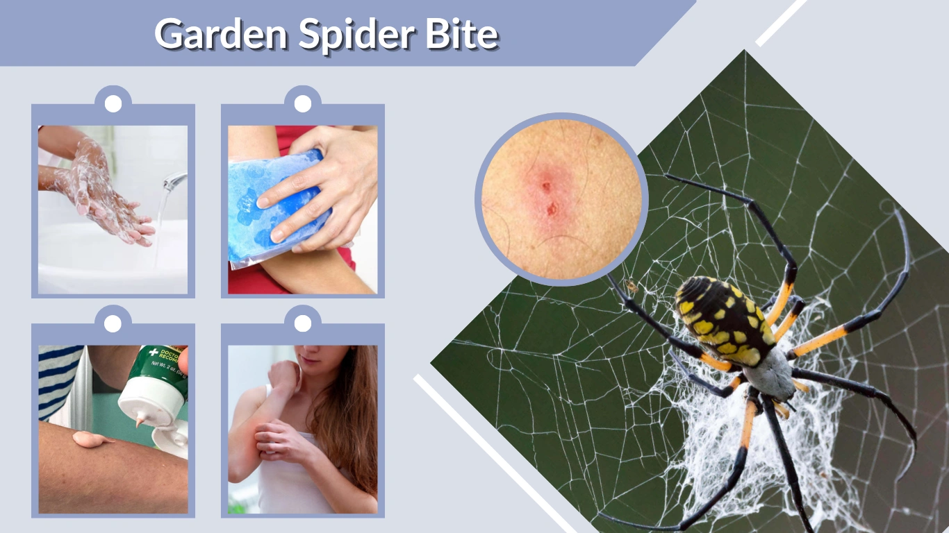 Garden Spider Bite Symptoms, Treatment, and Safety Guide