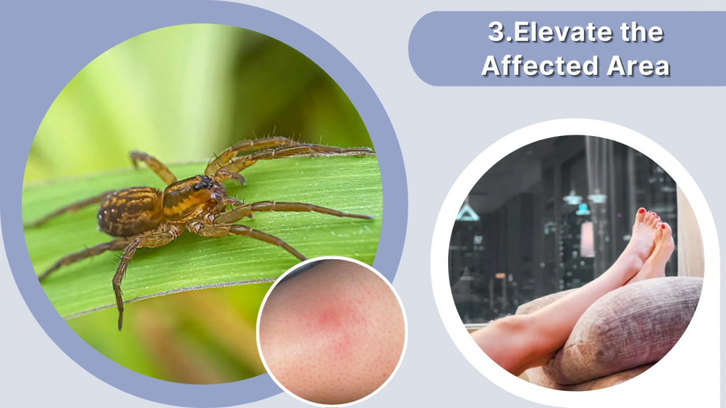 Spider Bite Treatment Elevate the Affected Area