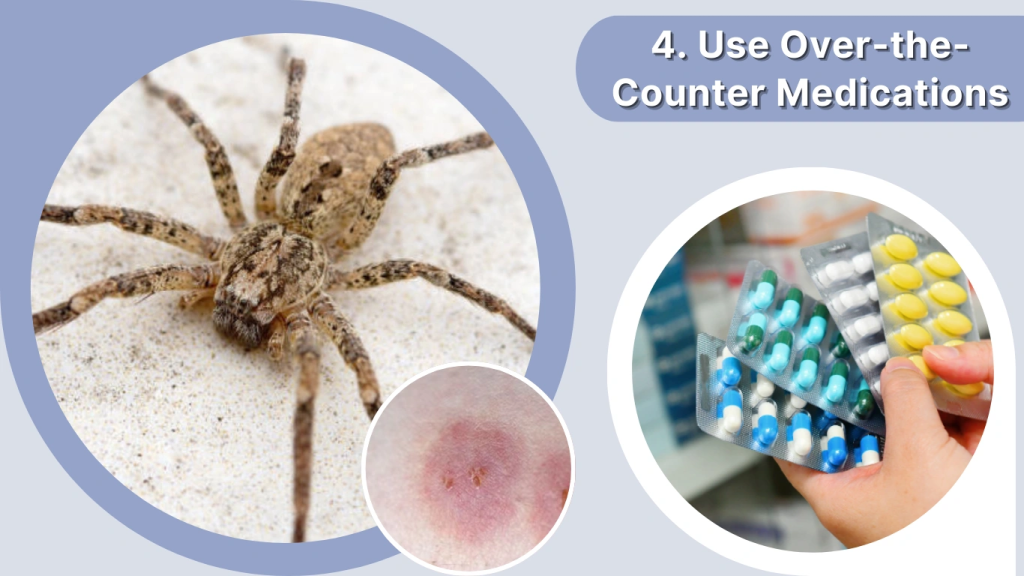 Spider Bite Treatment Use Over-the-Counter Medications