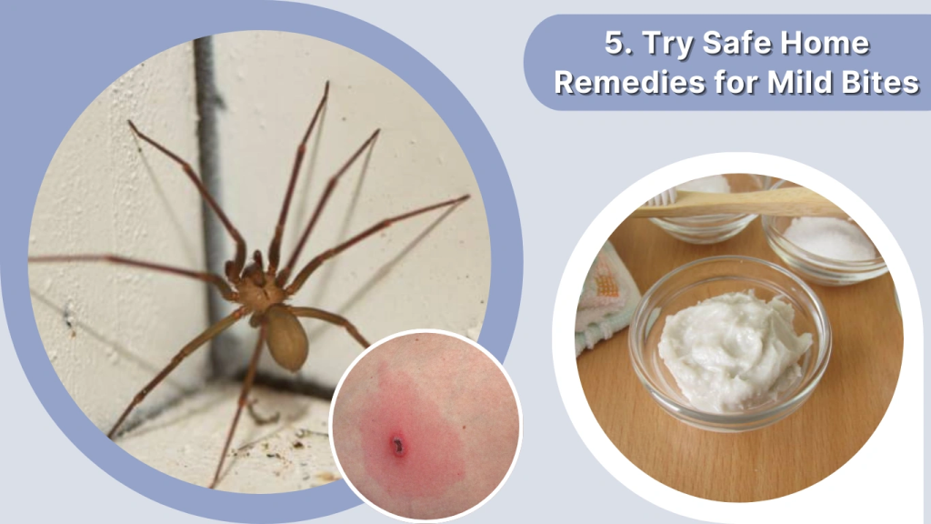 Spider Bite Treatment Try Safe Home Remedies for Mild Bites