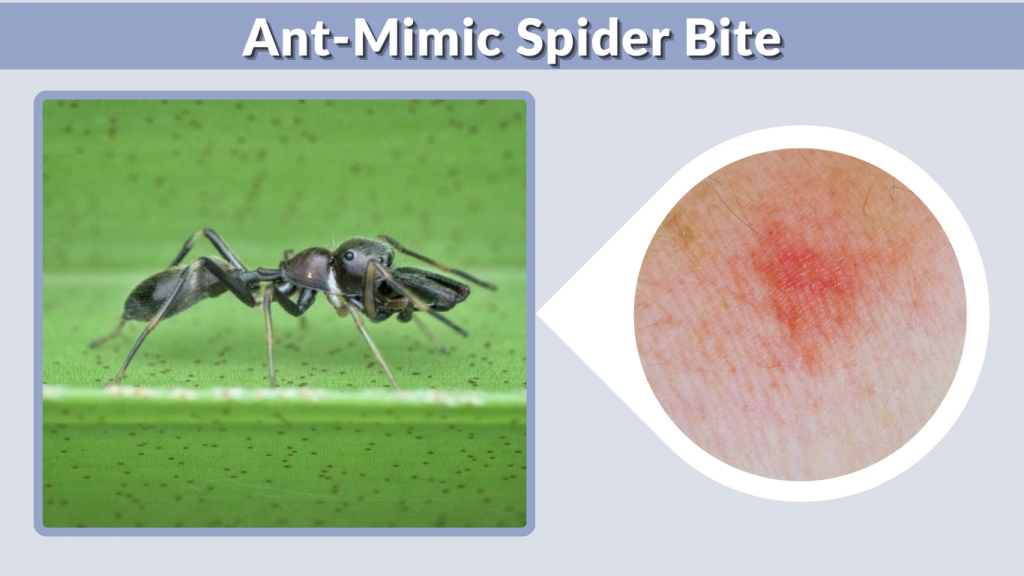 Ant-Mimic Spider Bite