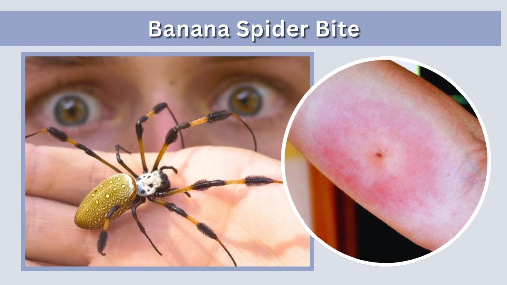 Banana Spider Bite