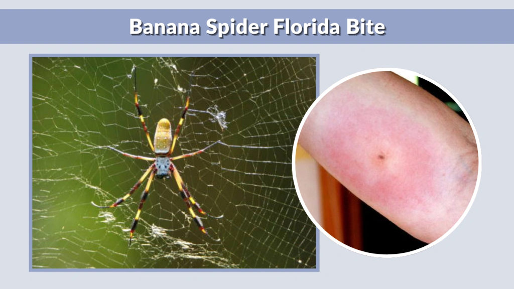 Banana Spider Florida Bite