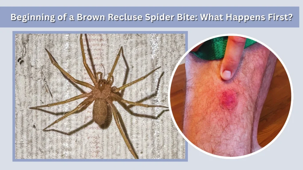 Beginning of a Brown Recluse Spider Bite What Happens First