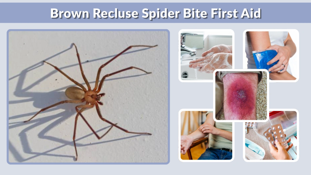 Brown Recluse Spider Bite First Aid