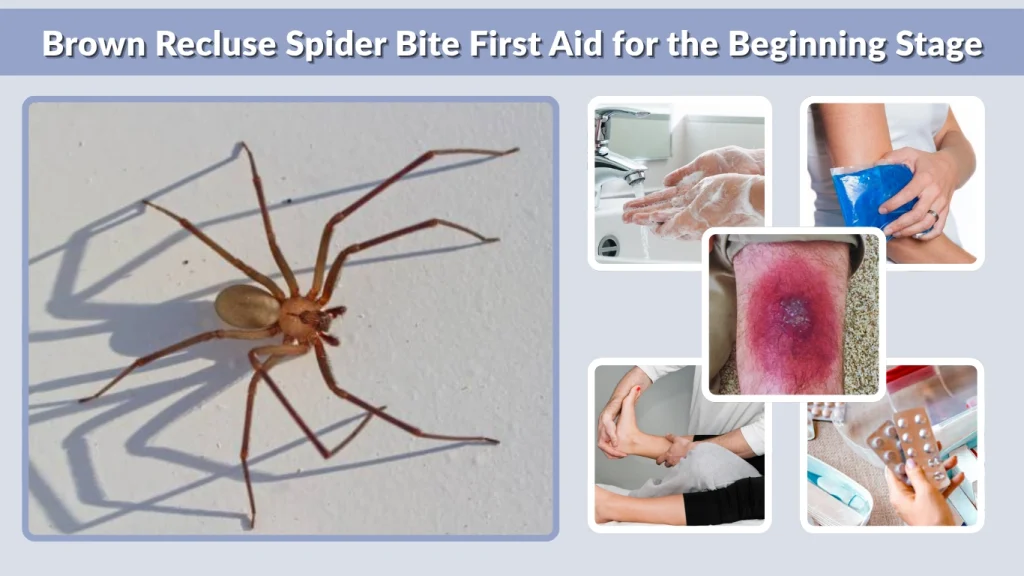 Brown Recluse Spider Bite First Aid for the Beginning Stage