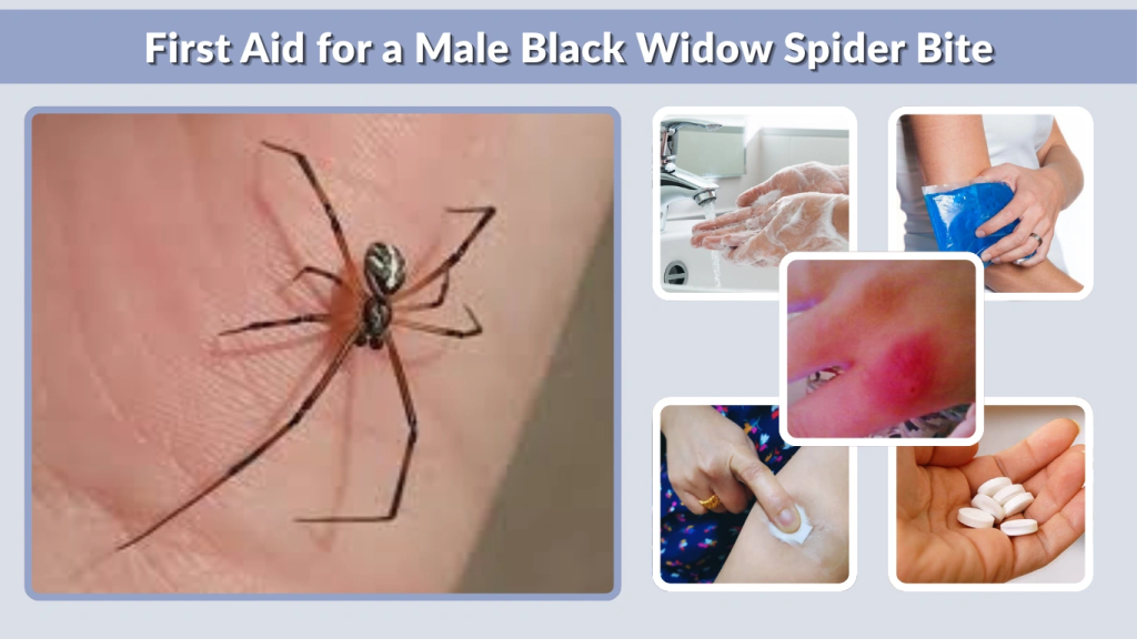 First Aid for a Male Black Widow Spider Bite