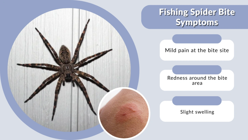 Fishing Spider Bite Symptoms