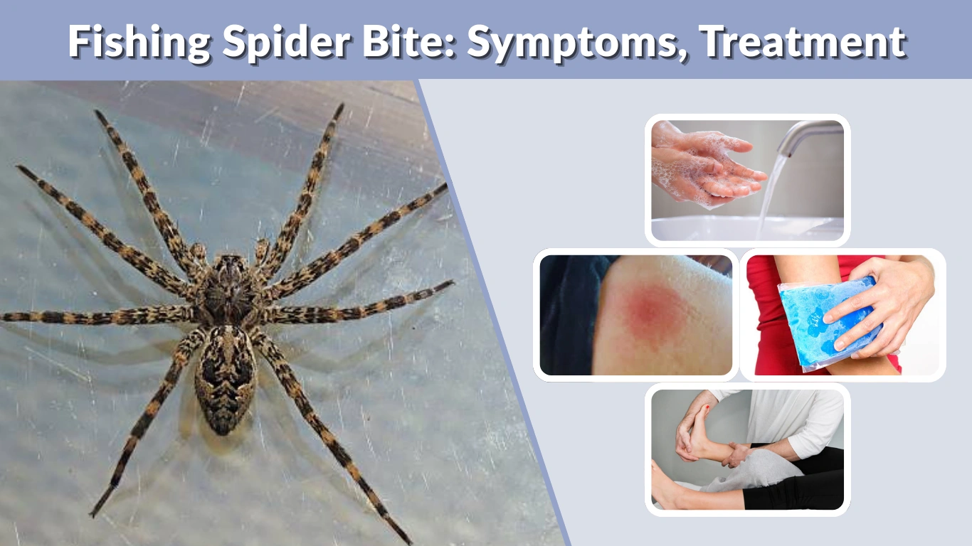 Fishing Spider Bite Symptoms, Treatment & How Dangerous It Is