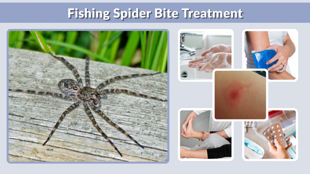 Fishing Spider Bite Treatment