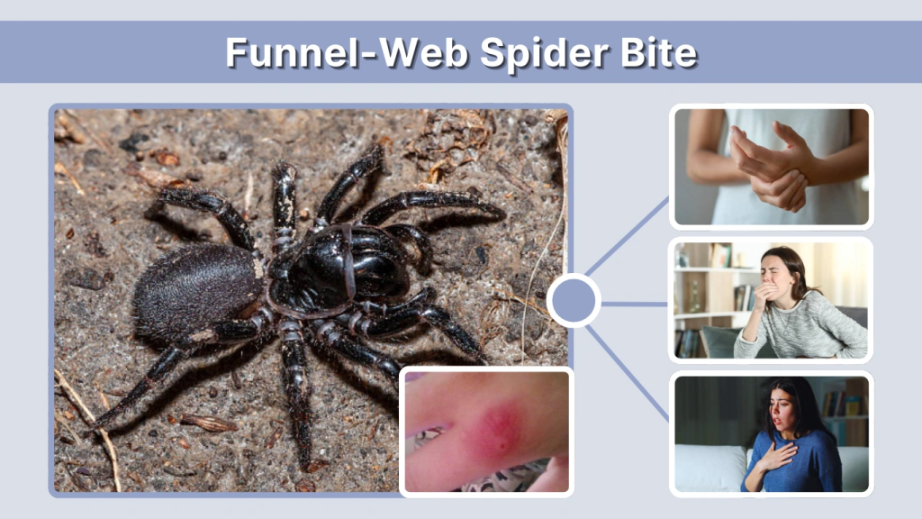 Funnel-Web Spider Bite