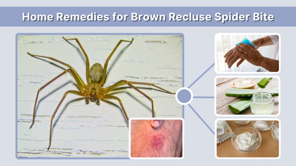 Home Remedies for Brown Recluse Spider Bite