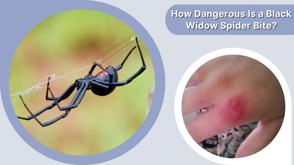 How Dangerous Is a Black Widow Spider Bite