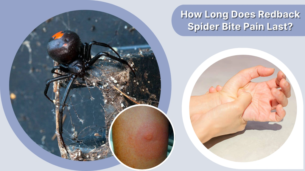 How Long Does Redback Spider Bite Pain Last