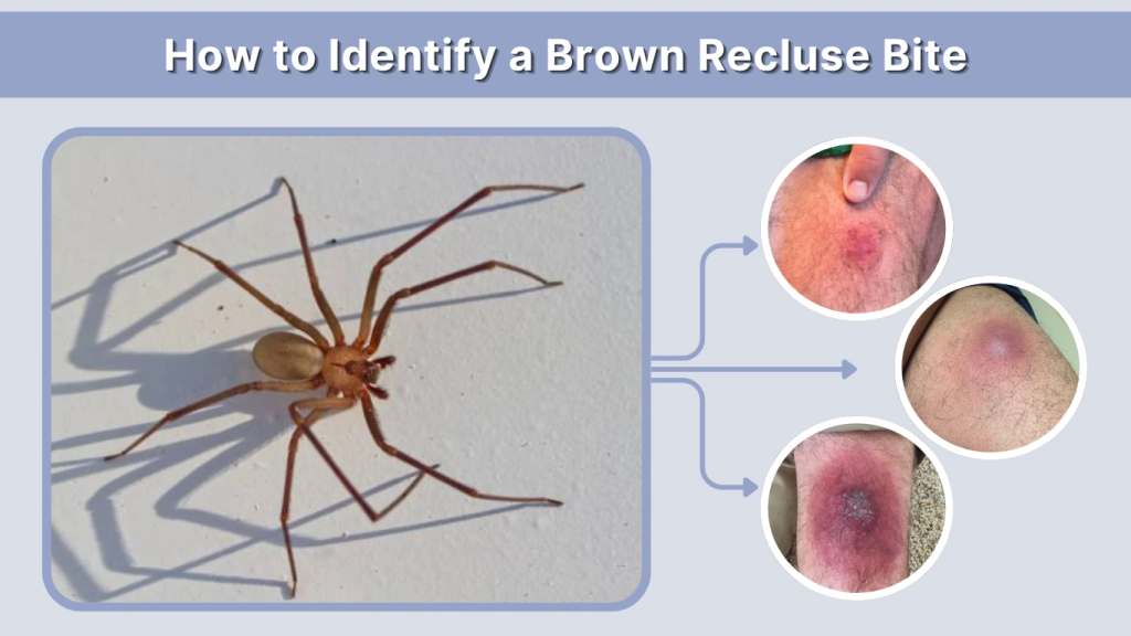 How to Identify a Brown Recluse Bite