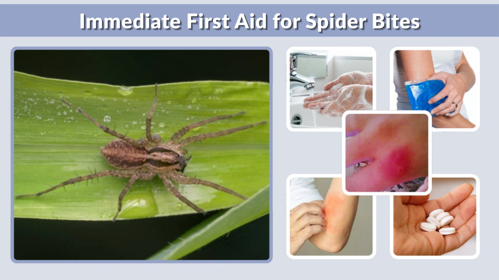 Immediate First Aid for Spider Bites