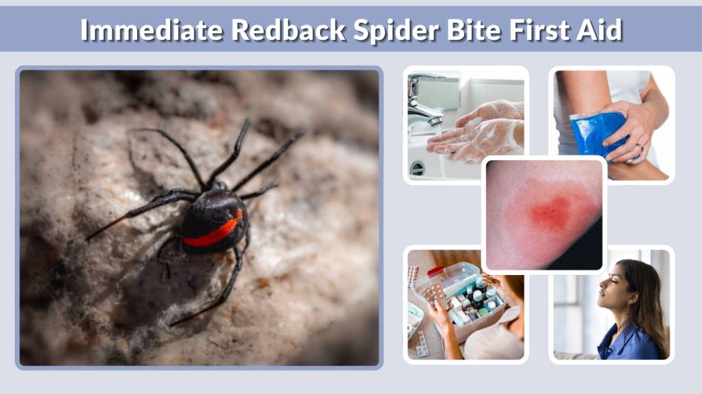 Immediate Redback Spider Bite First Aid
