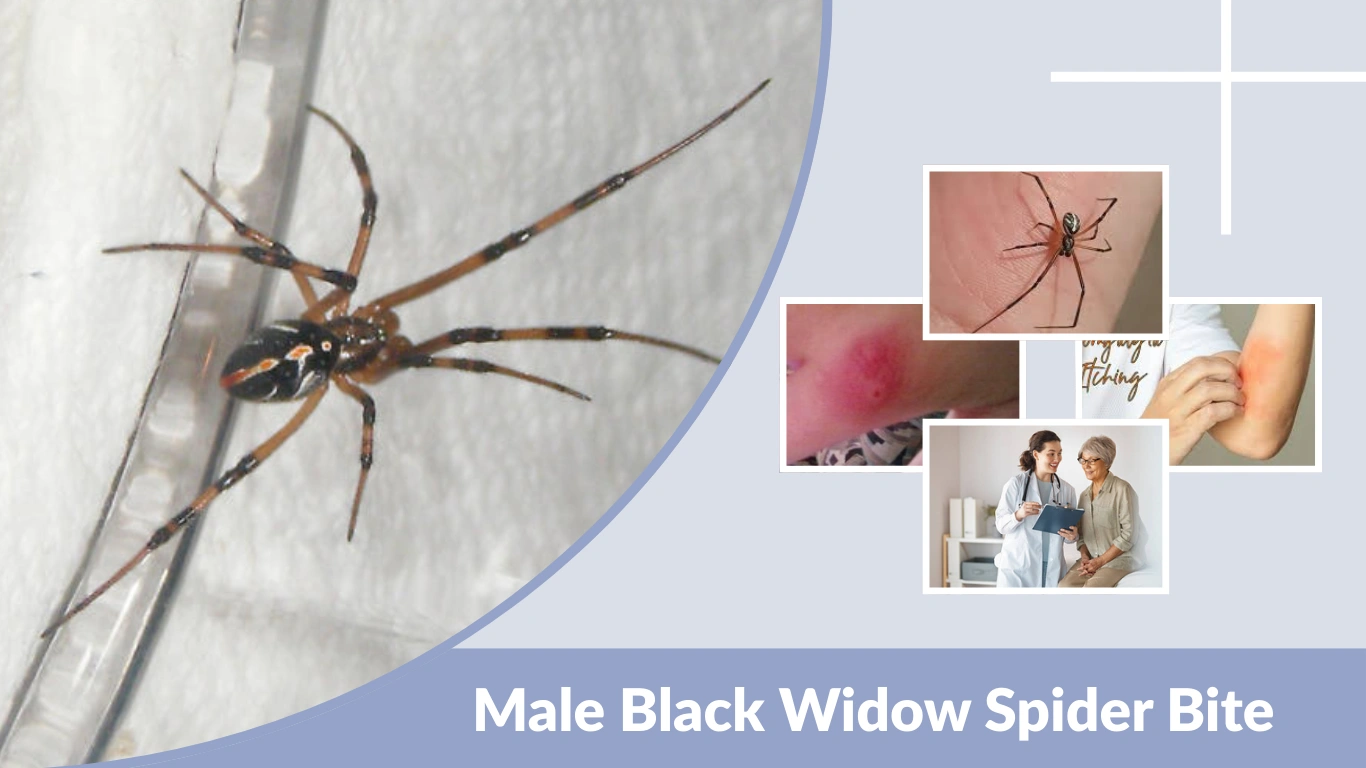 Male Black Widow Spider Bite: Symptoms, Risk & Treatment
