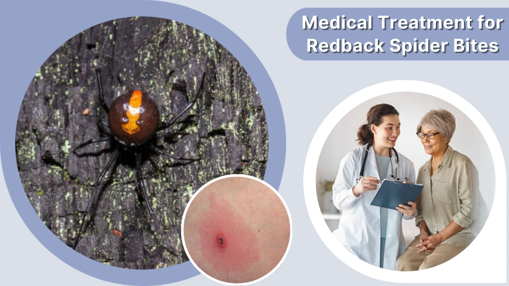 Medical Treatment for Redback Spider Bites