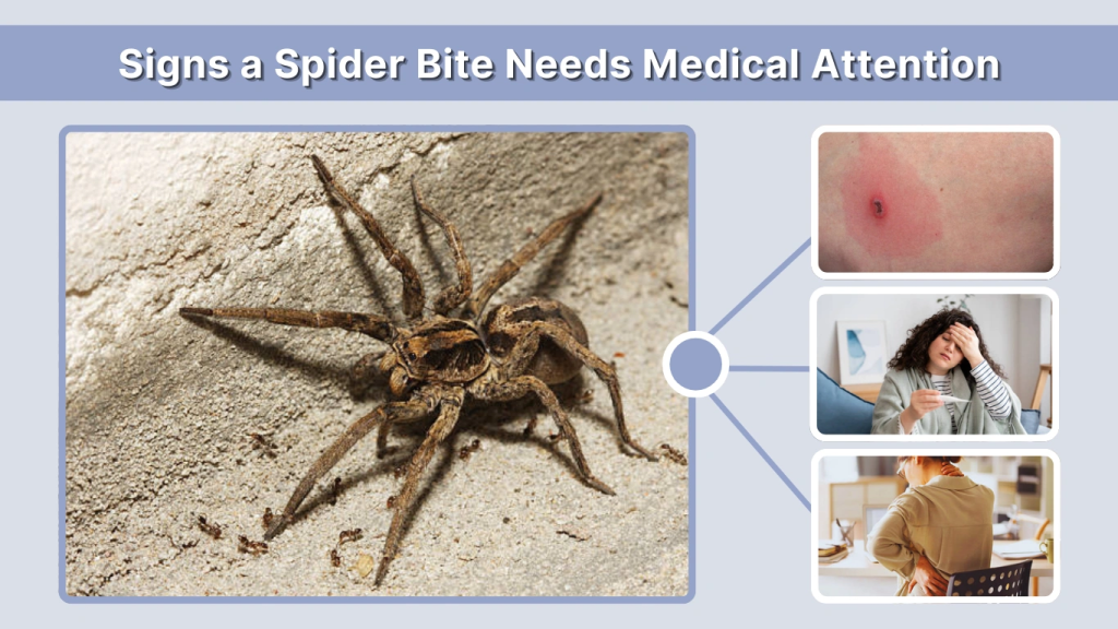 Signs a Spider Bite Needs Medical Attention