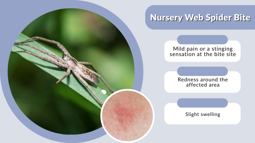 Nursery Web Spider Bite