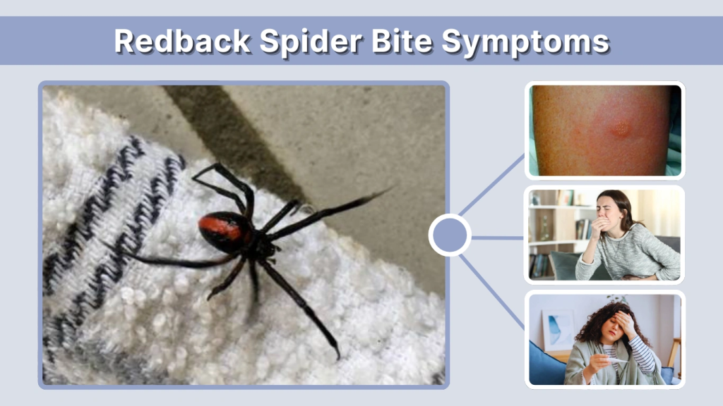 Redback Spider Bite Symptoms