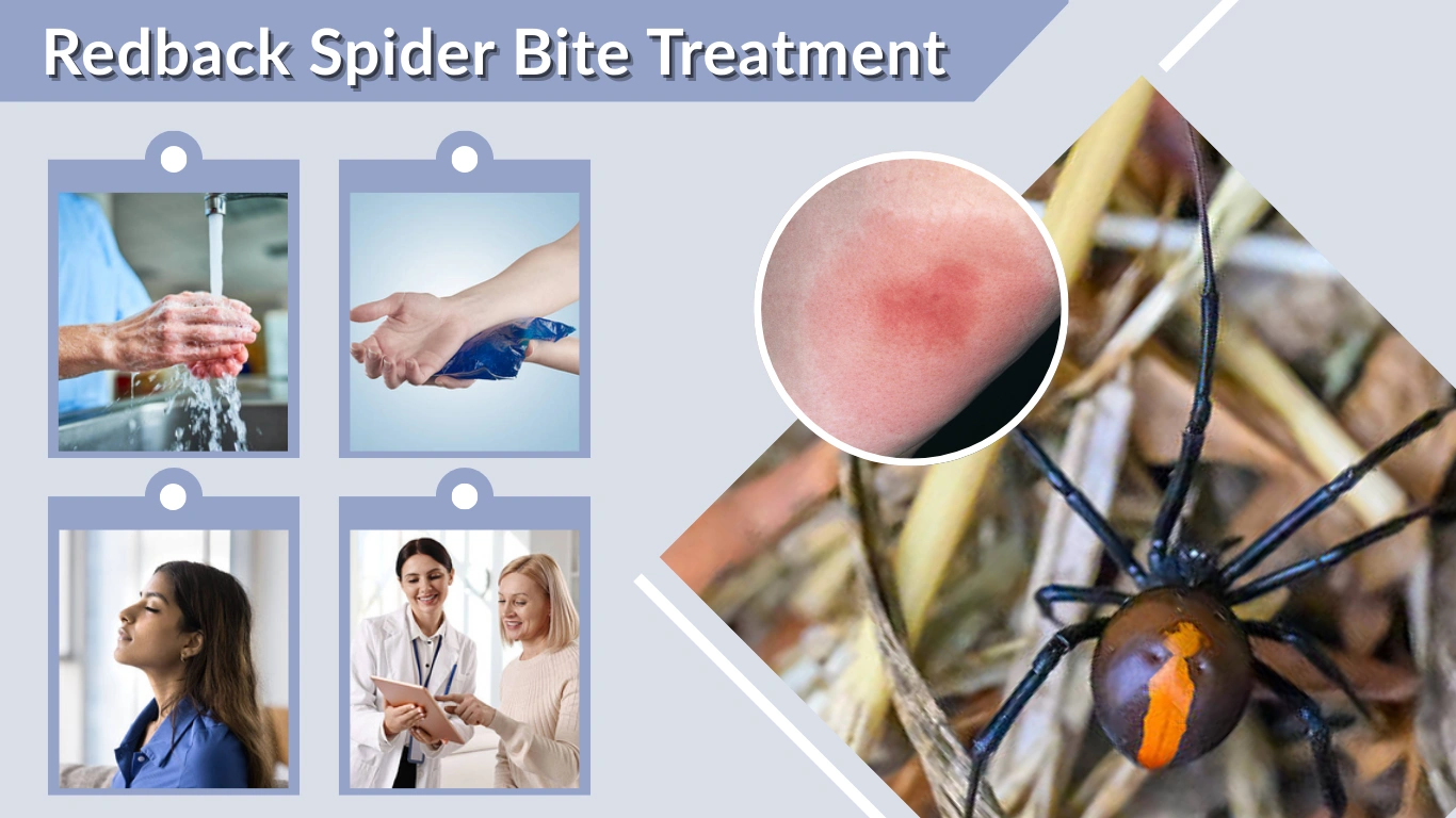 Redback Spider Bite Treatment Symptoms, First Aid & Recovery Guide