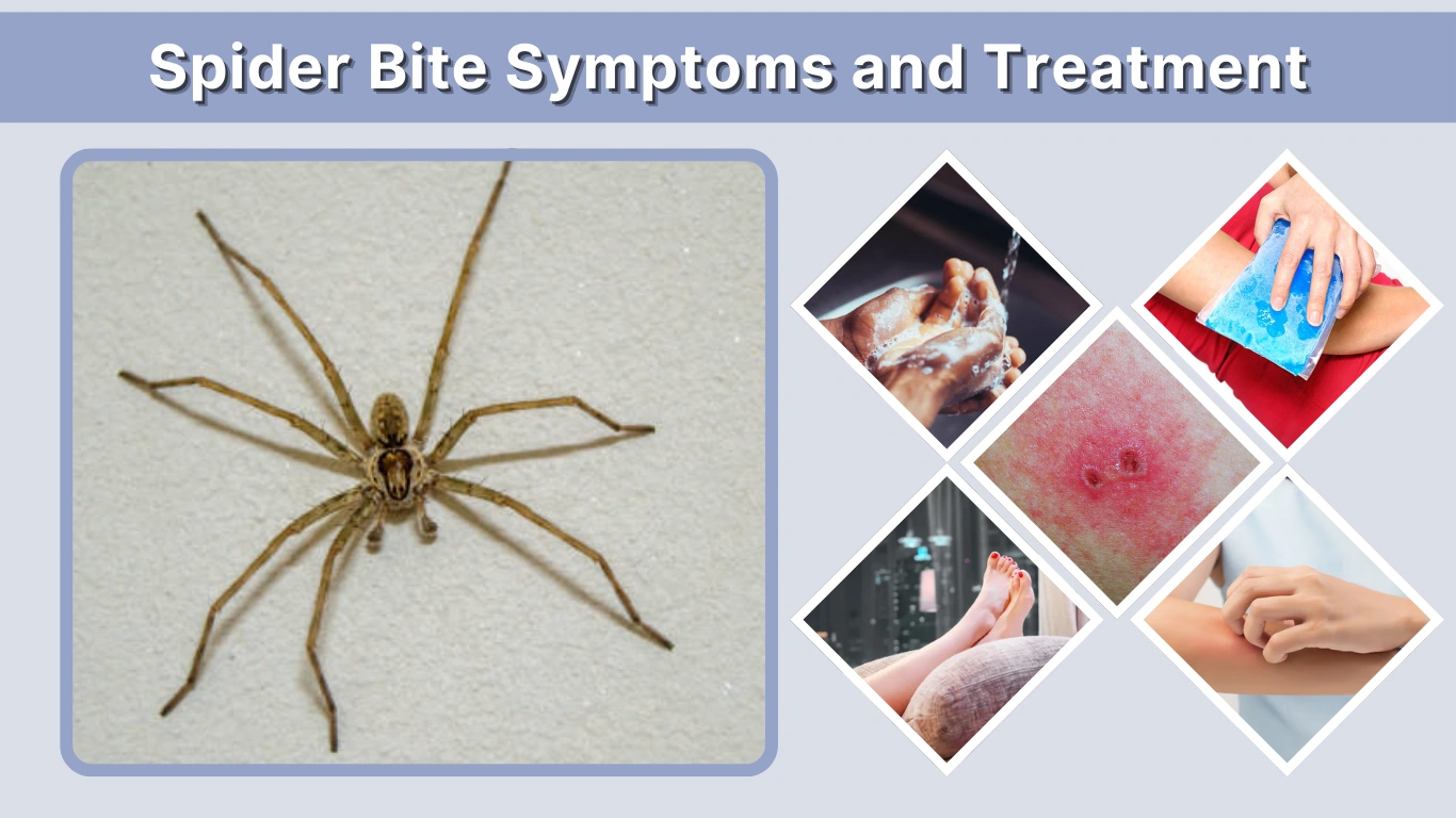 Spider Bite Symptoms and Treatment: Complete Guide