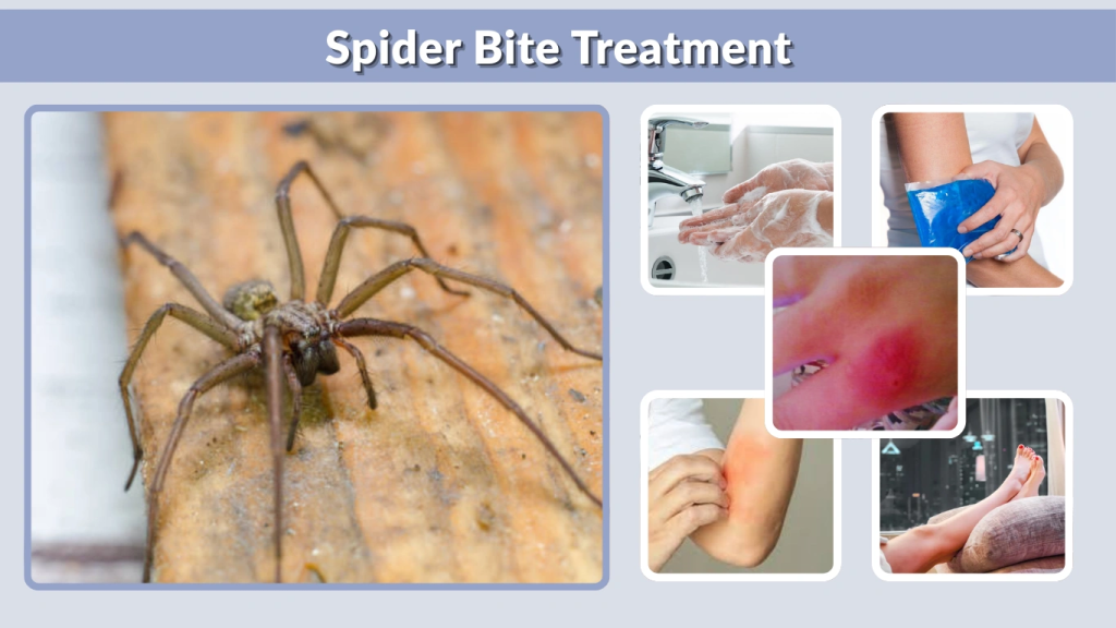 Spider Bite Treatment