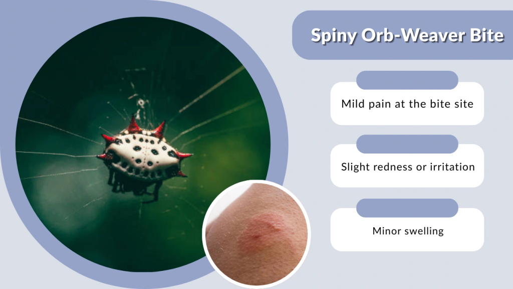 Spiny Orb-Weaver Bite