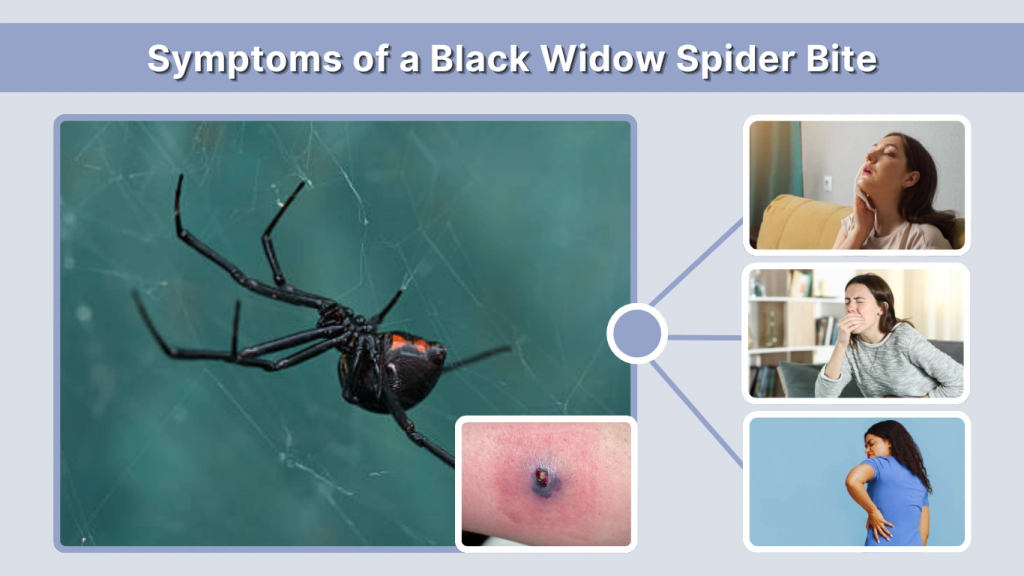 Symptoms of a Black Widow Spider Bite