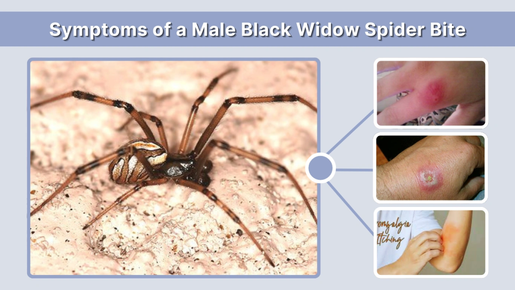 Symptoms of a Male Black Widow Spider Bite