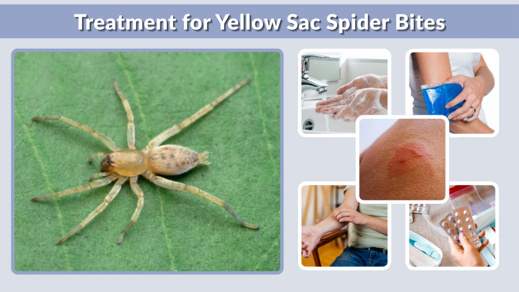 Treatment for Yellow Sac Spider Bites