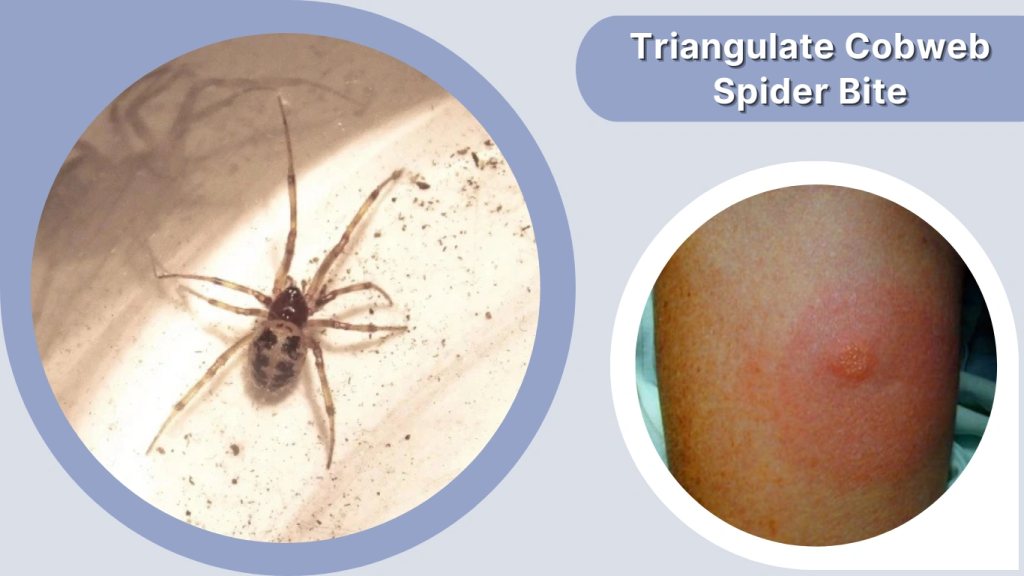 Triangulate Cobweb Spider Bite
