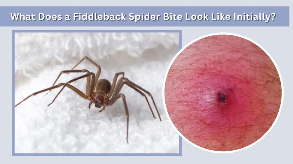What Does a Fiddleback Spider Bite Look Like Initially